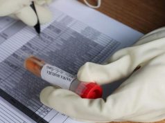 RSUD Cipayung Buka Suara Terkait Isu Mengcovidkan Pasien